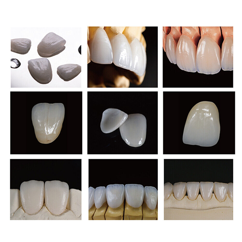 LT C14 Dental Glass Ceramic Lithium Dislicate Blocks Cerec Emax CAD CAM 5Pcs/Box