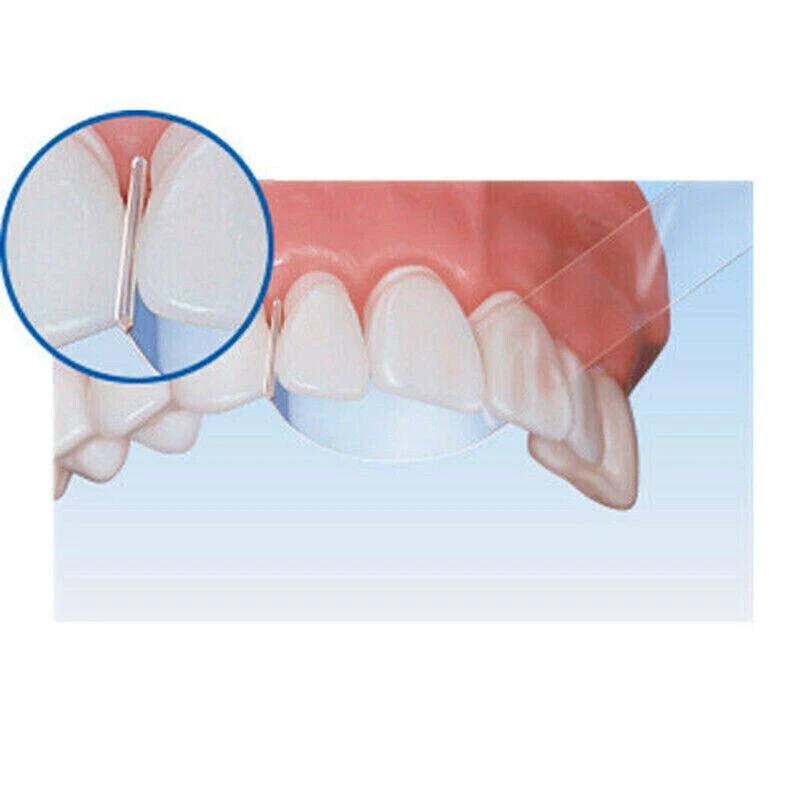 100 Pcs/Box Dental Plastic Strips Transparent For Crown Form TOP BM 1.040/1.041