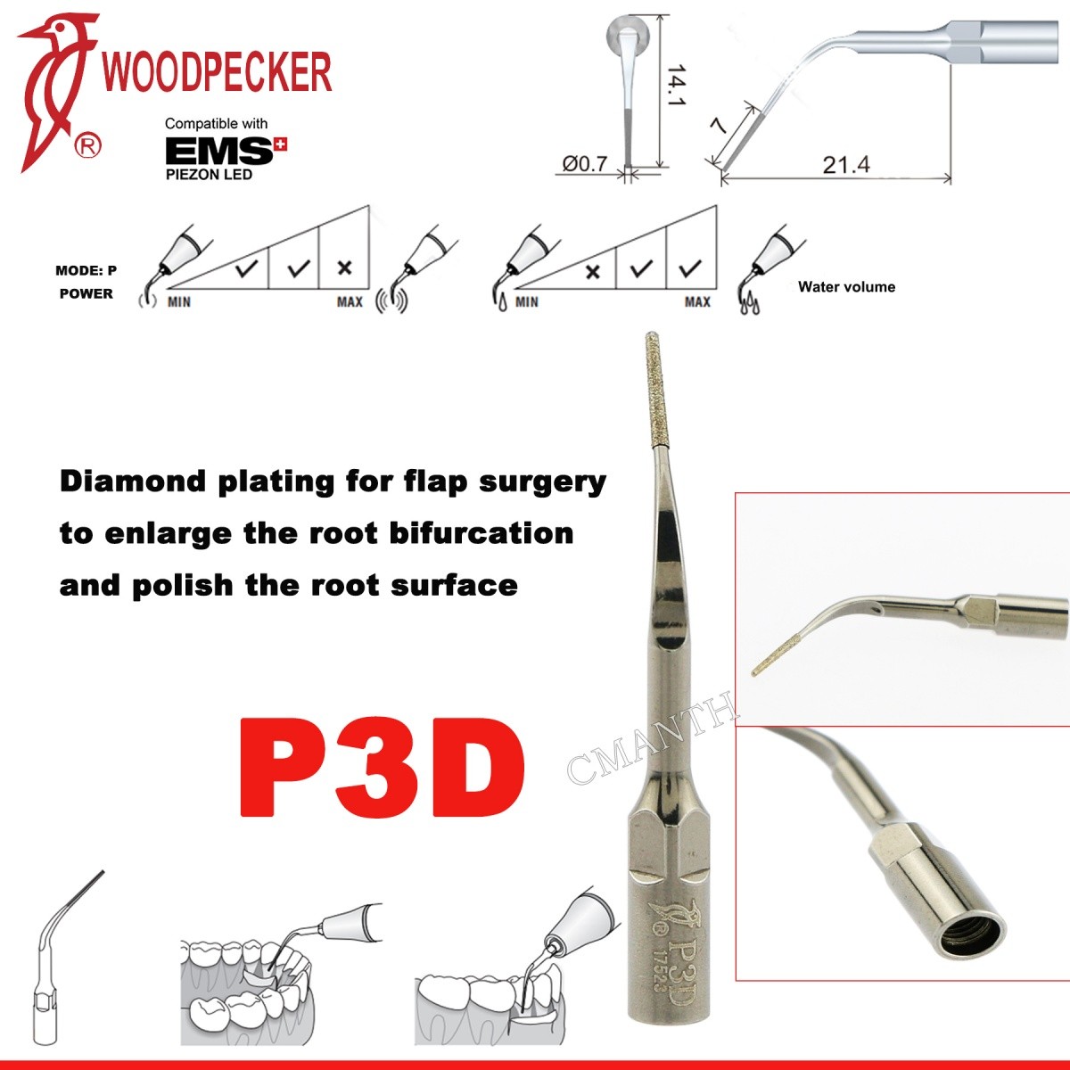 Woodpecker Dental Ultrasonic Scaler Tips P1-P33 Period Tips Fit EMS Scaler