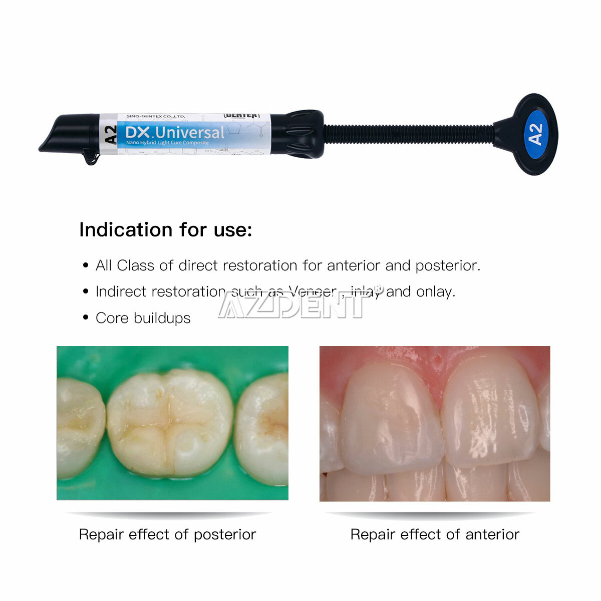 Dentex Dental Composite Light Cure Universal Resin /Acid Etching Gel 37%/Bonding