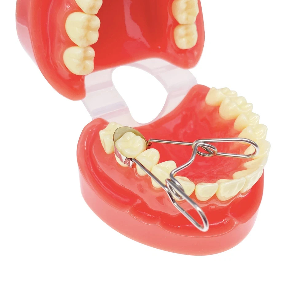 20Pcs/Pack Dental Saddle Contoured Matrix Metal Matrices Bands Spring clip